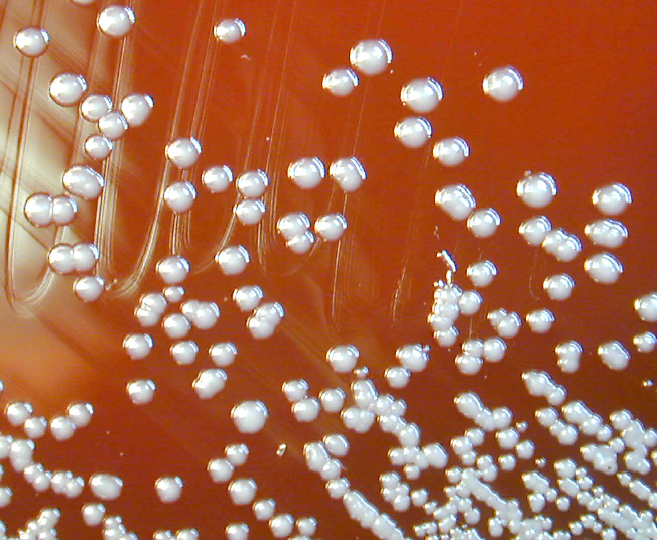 Imagem de referência relacionada a Burkholderia, item descrito como registro de referência sobre Burkholderia, organizado a partir de dados estruturados abertos