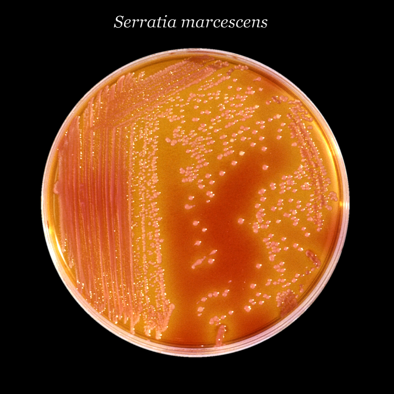 Imagem de referência relacionada a Serratia marcescens, item descrito como registro de referência sobre Serratia marcescens, organizado a partir de dados estruturados abertos
