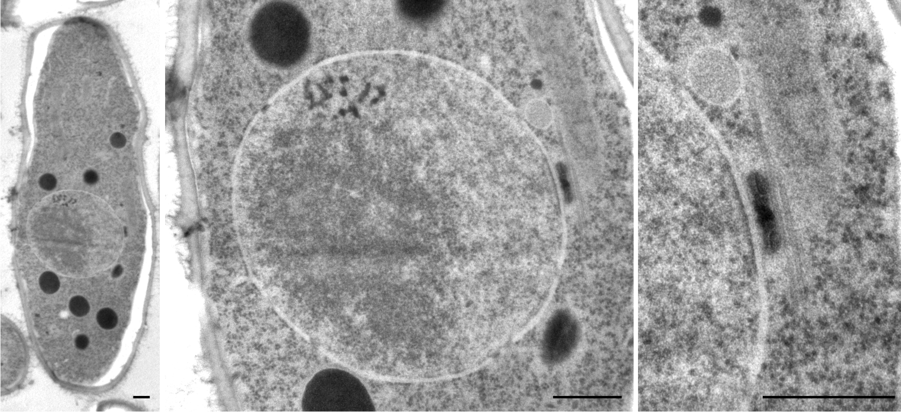 Imagem de referência de Schizosaccharomyces, descrito nos dados abertos como género de fungos