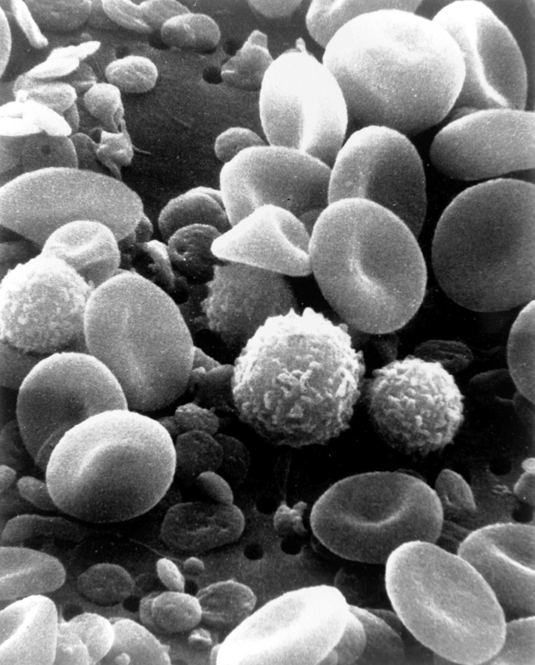 Imagem de referência relacionada a hematologia, item descrito como registro de referência sobre hematologia, organizado a partir de dados estruturados abertos