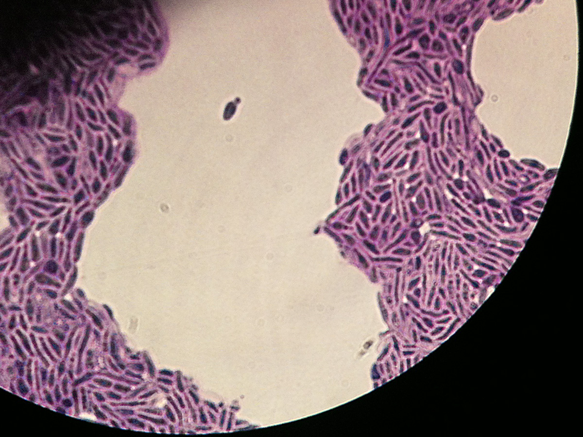 Imagem de referência relacionada a Microbotryomycetes, item descrito como registro de referência sobre Microbotryomycetes, organizado a partir de dados estruturados abertos