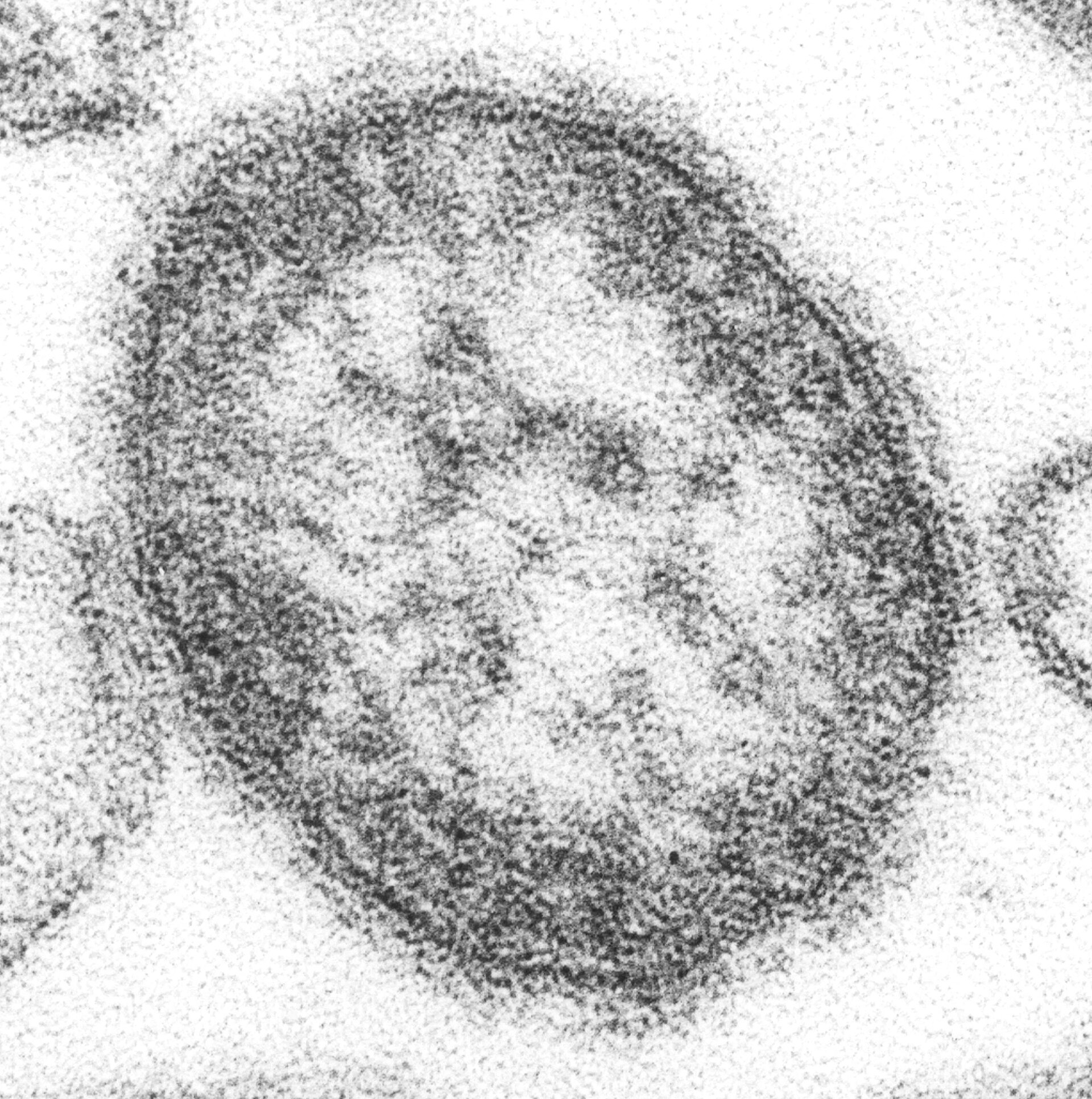 Imagem de referência de Morbillivirus, descrito nos dados abertos como gênero de vírus