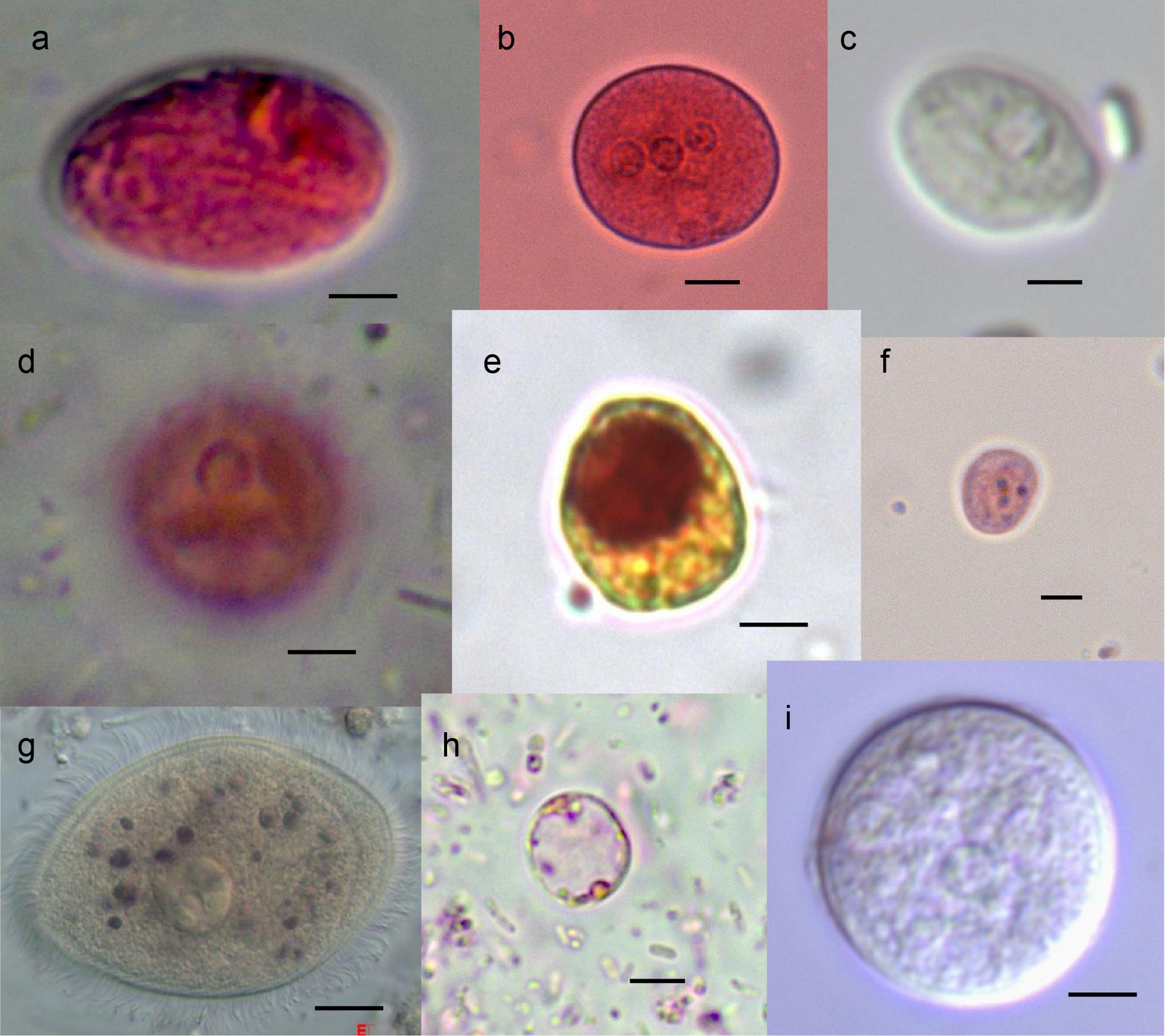 Imagem de referência relacionada a Balantidium coli, item descrito como balantidium coli