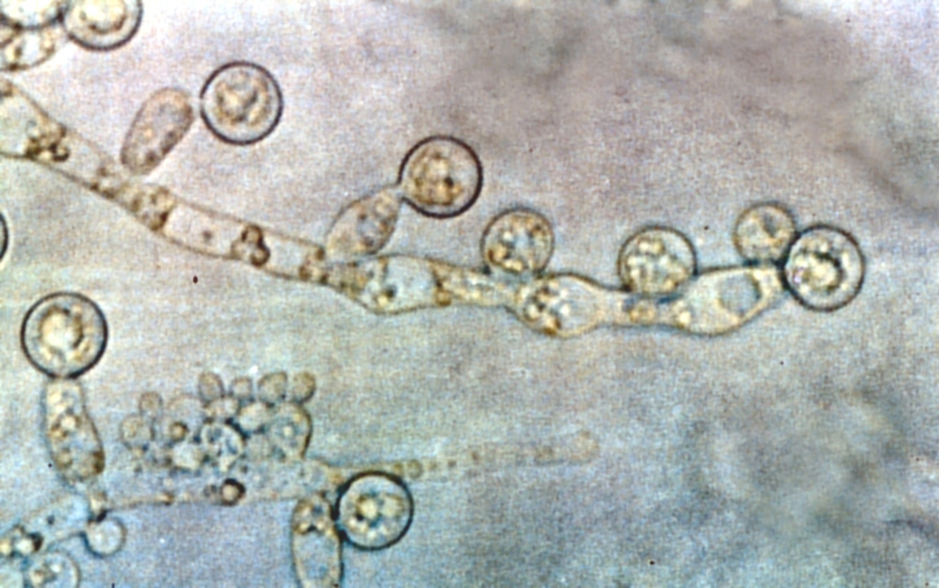 Imagem de referência de Candida albicans, descrito nos dados abertos como espécie de fungo