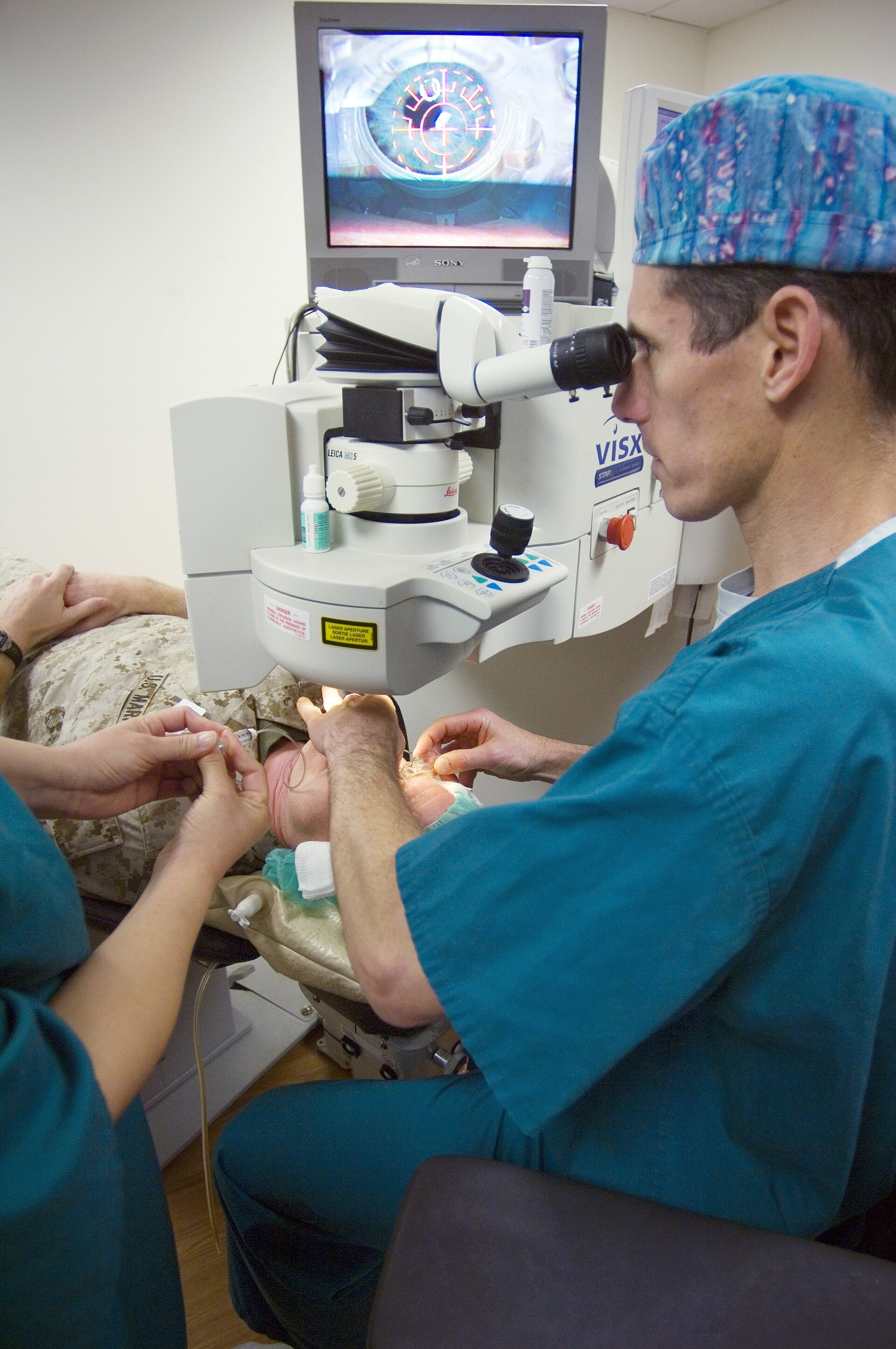 Imagem de referência de LASIK, descrito nos dados abertos como cirurgia ocular realizada para corrigir deformações na córnea