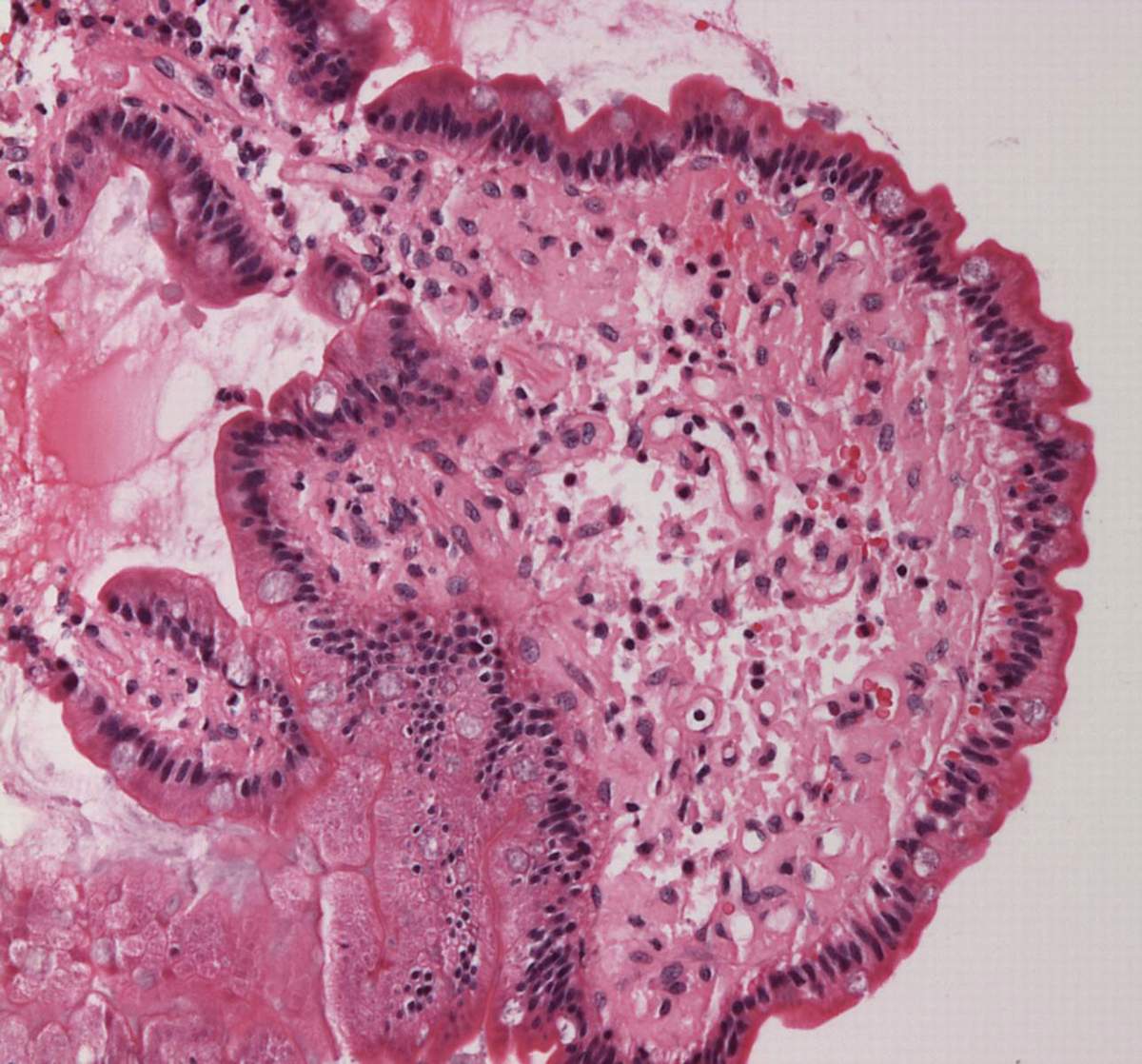Imagem de referência de intestino delgado, descrito nos dados abertos como o Intestino delgado é uma parte do tubo digestivo com a função de absorver os alimentos recém chegados do estômago